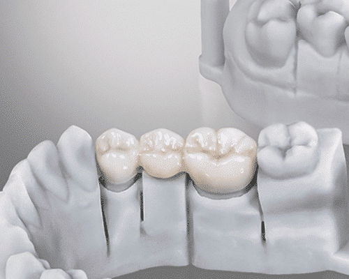 Résine DETAX Freeprint temp - 500 g – Image 3